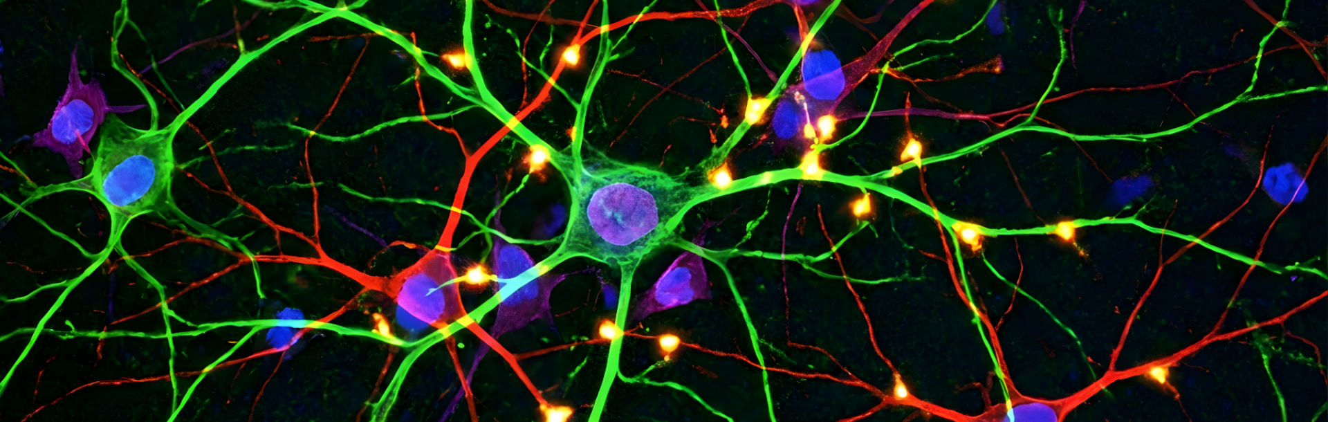 New Mechanism May Slow Huntington’s Disease