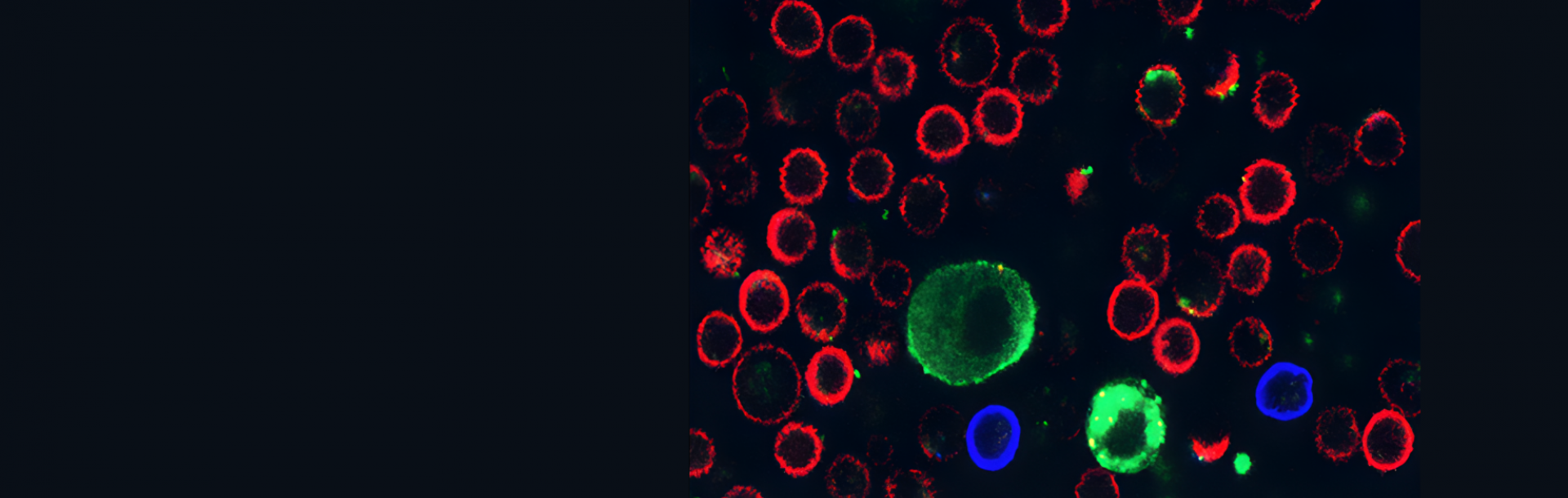 Breakthrough for treating the deadliest skin cancer