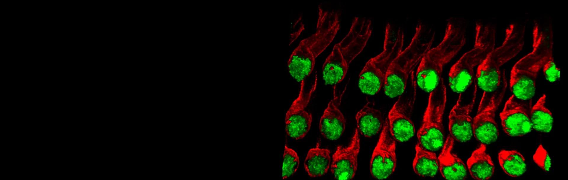Researchers Identify the Cells That Trigger Hearing Cell Regeneration