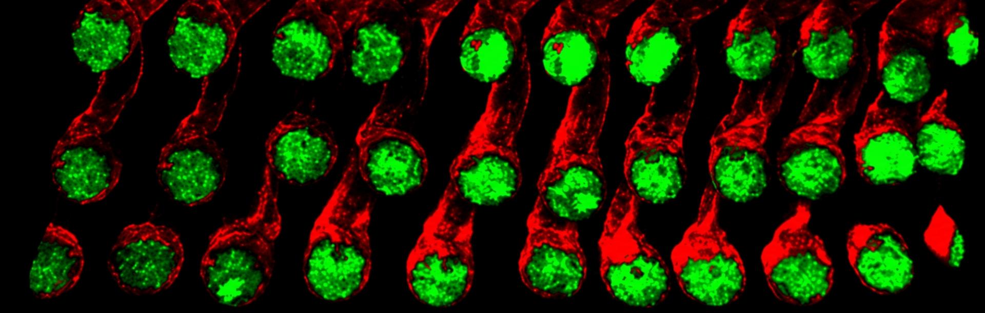 A study by Lama Khalaily and Prof. Karen B. Avraham uncovers rare inner ear cells that can regenerate hearing.