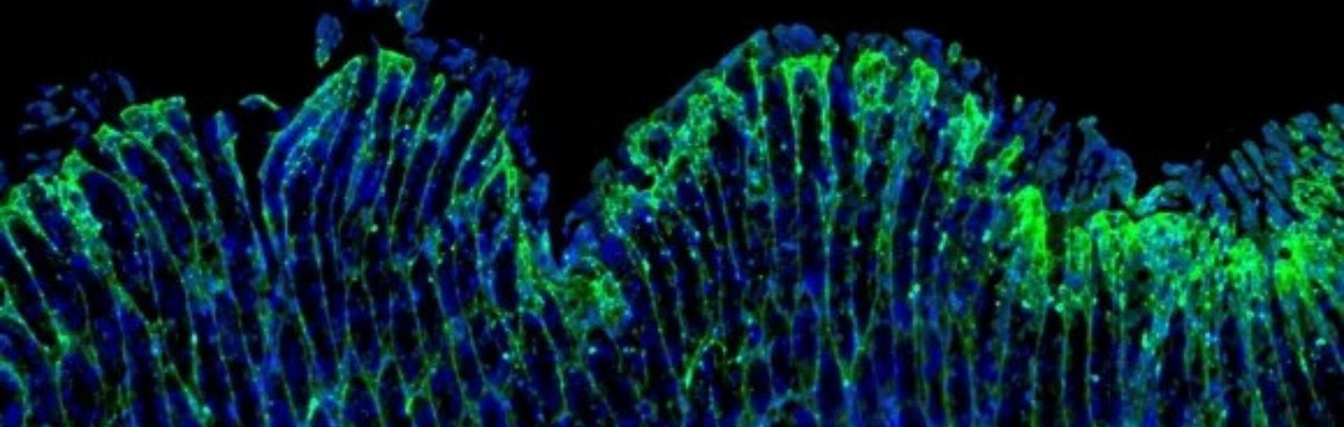 A study by Prof. Ariel Munitz and colleagues reveals that two key immune receptors play different roles in the development of eosinophilic gastritis, offering new insights that could guide future targeted therapies