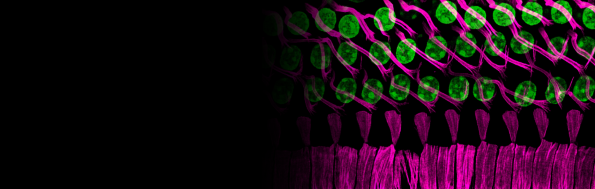 New Gene Discovery Reveals Key Role of Formin-1 in Hearing