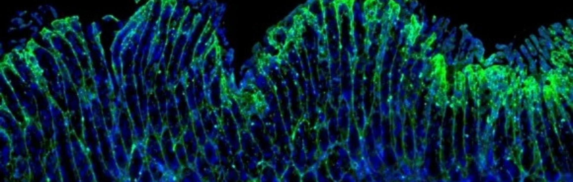 Researchers reveal distinct immune mechanisms in eosinophilic gastritis