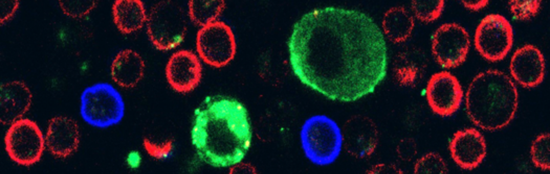 Breakthrough for treating the deadliest skin cancer