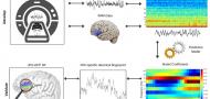 Neural and functional validation of fMRI-informed EEG model of right inferior frontal gyrus activity