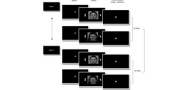 Neural activation changes following attention bias modification treatment or a selective serotonin reuptake inhibitor for social anxiety disorder