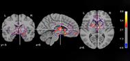 Reward-related regions play a role in natural story comprehension