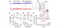 Deep brain stimulation of thalamic nucleus reuniens promotes neuronal and cognitive resilience in an Alzheimer’s disease mouse model