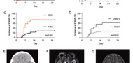 CD19 CAR T-cells for pediatric relapsed acute lymphoblastic leukemia with active CNS involvement: a retrospective international study