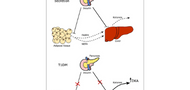 Fatty acid-binding protein 4: a key regulator of ketoacidosis in new-onset type 1 diabetes