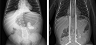 Nonrespiratory complications of nusinersen-treated spinal muscular atrophy type 1 patients