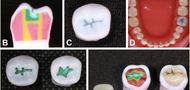 Does augmented visual feedback from novel, multicolored, three-dimensional-printed teeth affect dental students’ acquisition of manual skills?