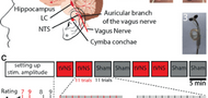 Transcutaneous vagus nerve stimulation in humans induces pupil dilation and attenuates alpha oscillations