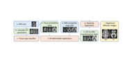 Tissue probability based registration of diffusion MRI Tissue probability based registration of diffusion MRI