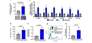 P-selectin inhibition alters microglia immunophenotype and blocks glioblastoma progression