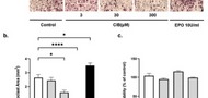The non-erythropoietic EPO analogue cibinetide inhibits osteoclastogenesis in vitro and increases bone mineral density in mice