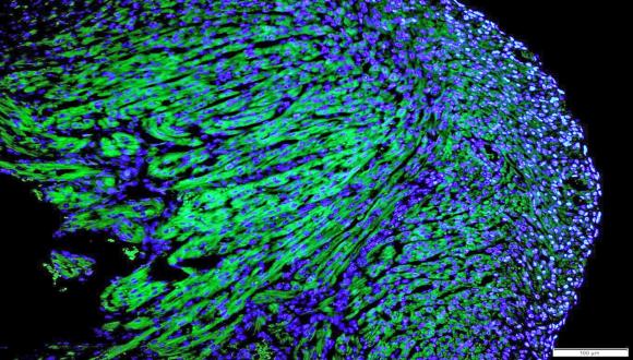  myocardial regeneration in mouse