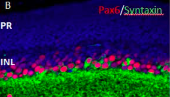 Adult retina gene Pax6