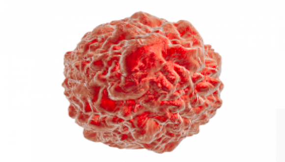 Engineered T Cells May Be Harnessed to Kill Solid Tumor Cells