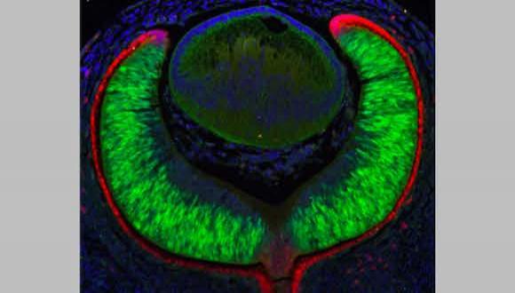 Mazal Cohen Gulkar PhD student awarded Excellence Prize in Ophthalmology on behalf of Prof. Moshe Lahav