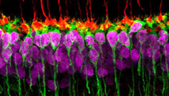 How to build a synapse: molecules that instruct neuron form and function with Dr. Melanie Samuel
